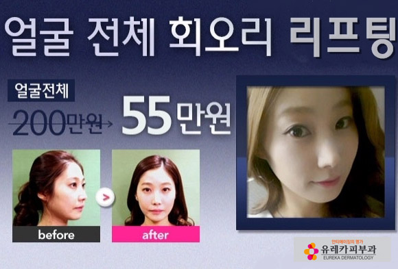 이벤트 5(BS안과)